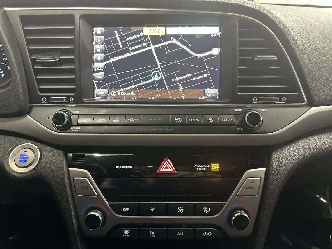 2017 Hyundai Elantra Limited Sedan 4D