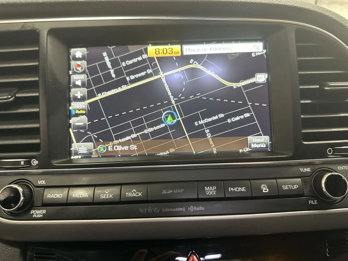 2017 Hyundai Elantra Limited Sedan 4D